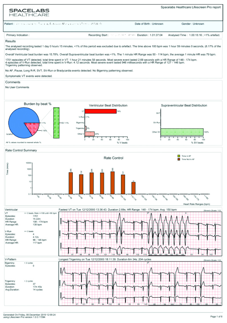 Final reports can display up to 30 days of results, including commentary, arrhythmia burden graphs, a comprehensive atrial fibrillation section, patient symptom correlation, and relevant ECG strips.